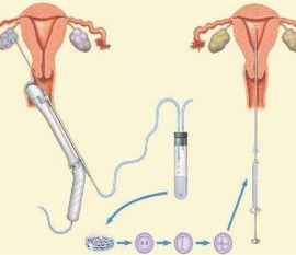 35岁女性备孕请做好以下检查，“健康上海代生宝宝”跑不远